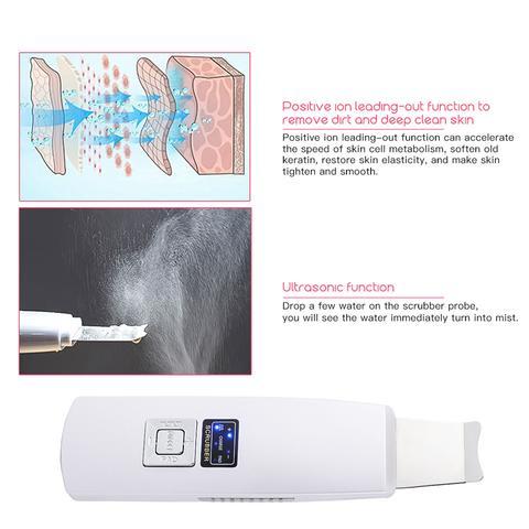 Ultrasonic Skin Scrubber Face Cleanser Blackhead Acne Removal Facial - Cart2u.ro