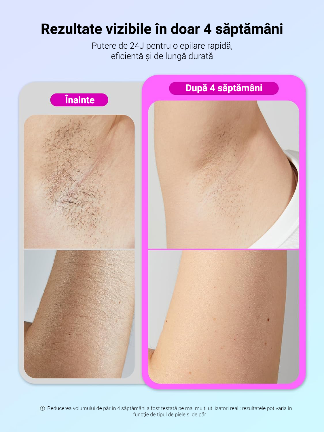 Epilator IPL Wavytalk Aura Beauty