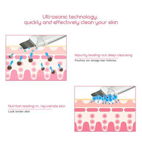 Ultrasonic Skin Scrubber Face Cleanser Blackhead Acne Removal Facial - Cart2u.ro