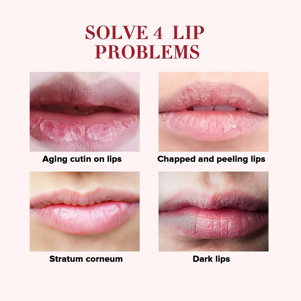 Rose Cherry Honey Peach Lipstick Moisturizing Lip Mask, Unisex Lip - Cart2u.ro