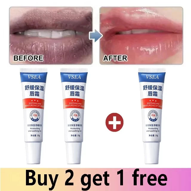 Remove Dark Lip Balm Fast Lightening Pink Lip Exfoliating Fade Lip - Cart2u.ro