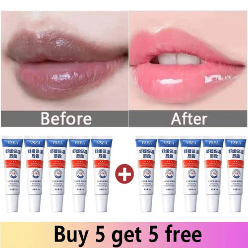 Remove Dark Lip Balm Fast Lightening Pink Lip Exfoliating Fade Lip - Cart2u.ro